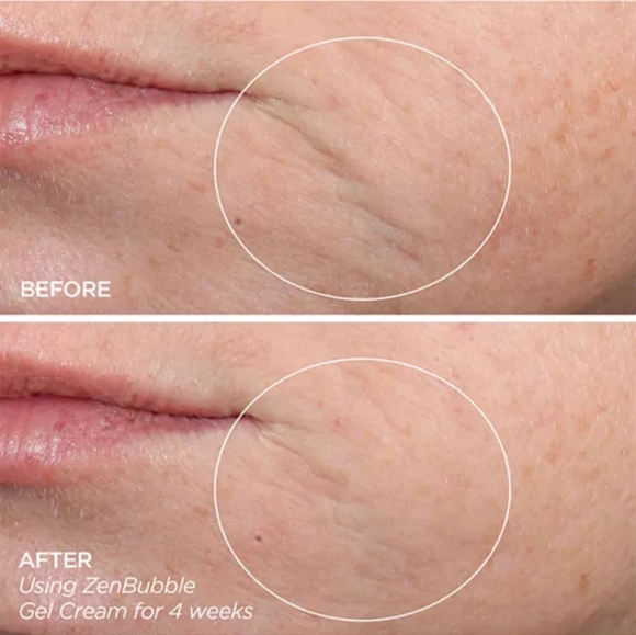 Beauty Bio Microneedle, Zen Bubble Moisturizer, & The Balance Cleanser Set - Picture 10 of 15